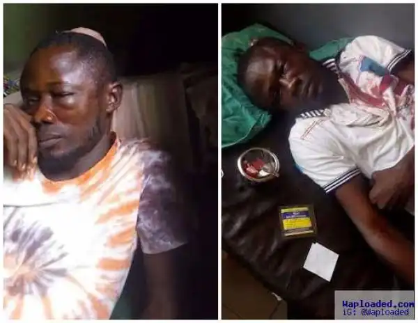 See How Man Was Beaten By Political Thugs In Edo State - PHOTOS!